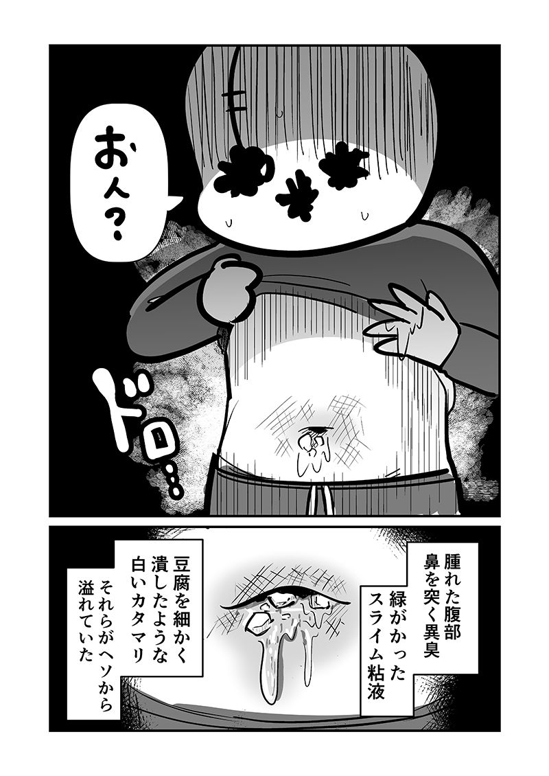 〆切に追われて栄養剤＋仮眠を繰り返していたらおヘソから膿が出て入院した話2 サンプル画像4