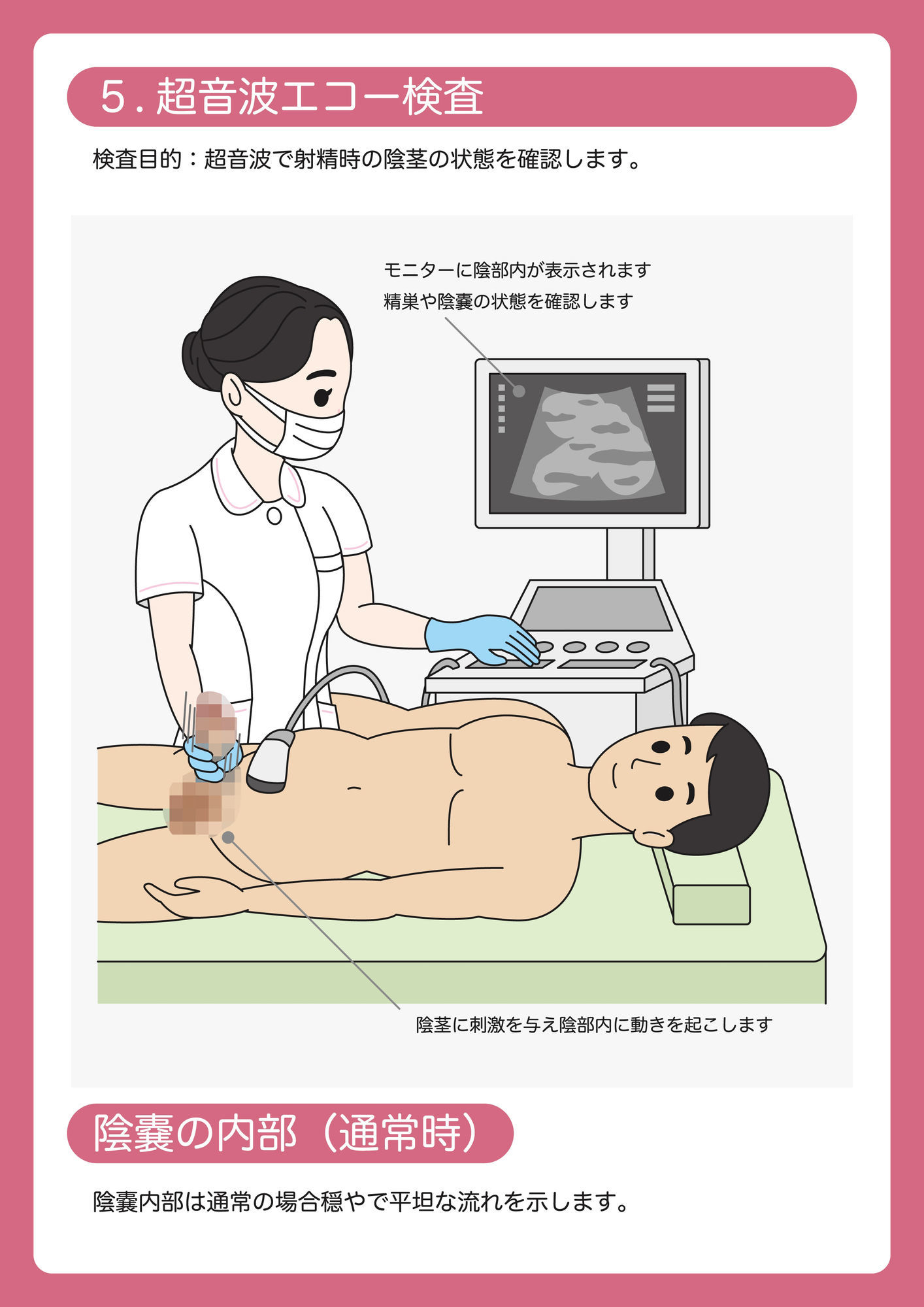 陰茎健診のご案内 サンプル画像6
