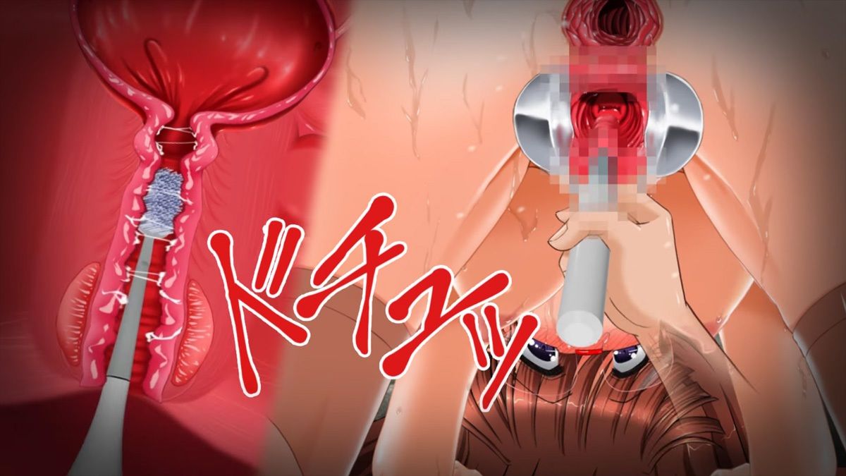肉奴●志願〜100日間の拡張調教〜アニメーション全集 サンプル画像8